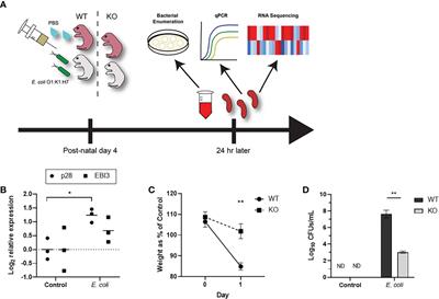 Interleukin-27-dependent transcriptome signatures during neonatal sepsis